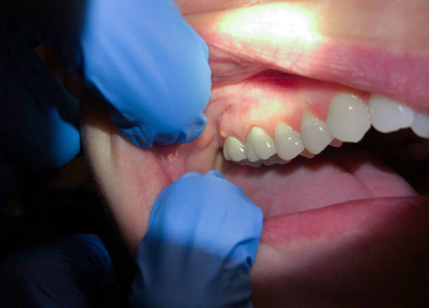 Best Emergency Dental Extractions in Stamps, AR