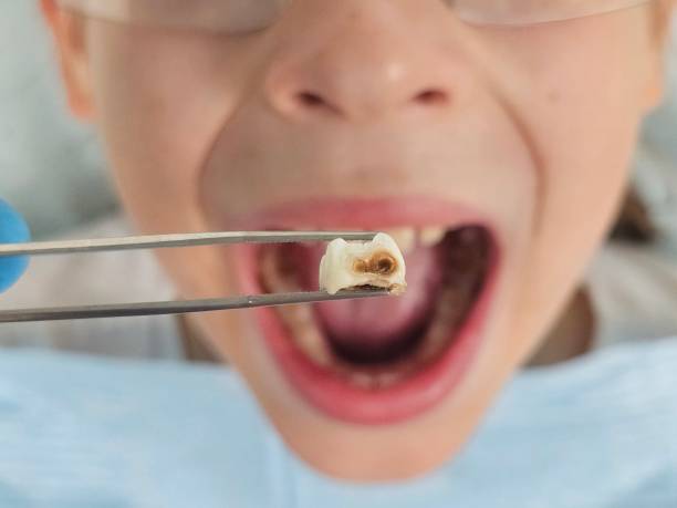 Best Emergency Dental Extractions in Stamps, AR